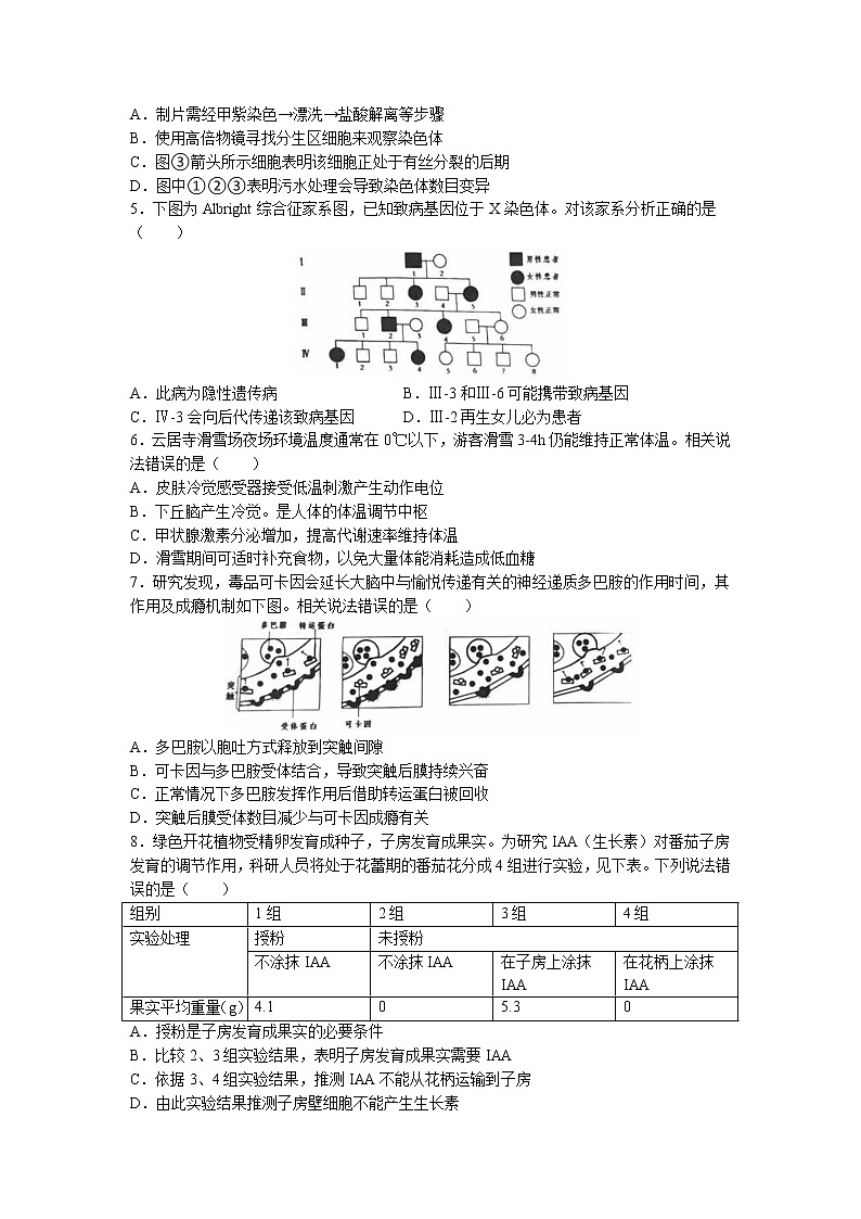 北京市房山区2023届高三下学期一模试题 生物 Word版无答案02