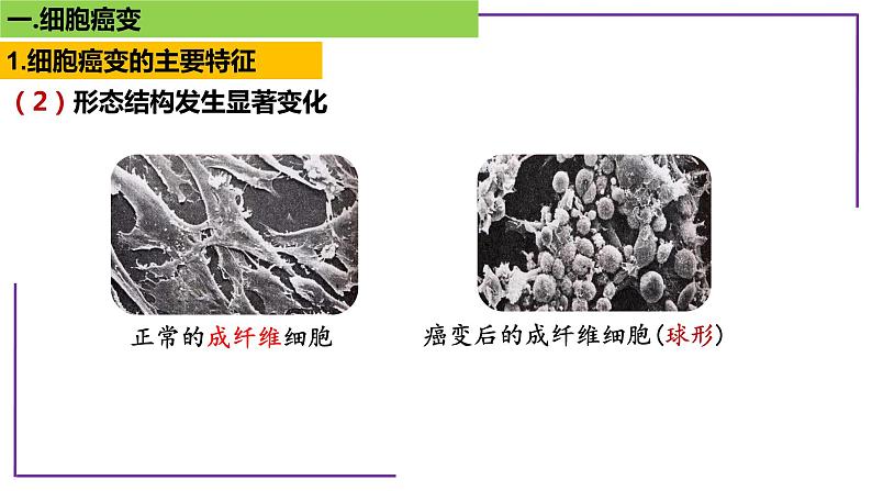 专题4 细胞癌变-【热点专栏】备战2022年高考生物热点知识及技巧名师精讲课件第4页