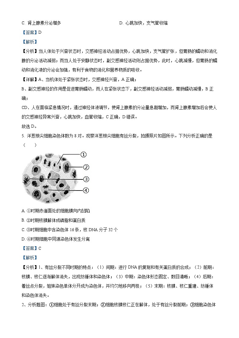 2023届浙江省绍兴市上虞市高三第二次适应性考试生物试题  Word版含解析03