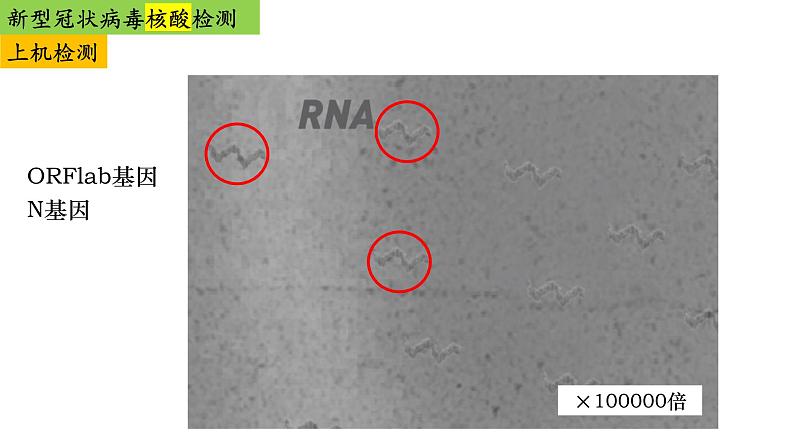 2023届高三生物复习课件高考热点-新冠病毒的检测专题复习第7页