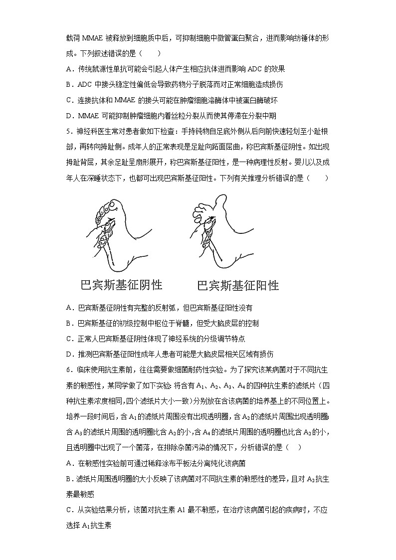 2023届江苏省前黄高级中学高三考前攀登行动（二）生物试题（含解析）02