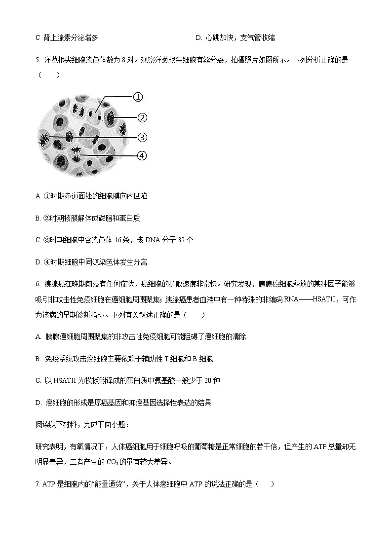 2023届浙江省绍兴市上虞市高三第二次适应性考试生物试题含答案02