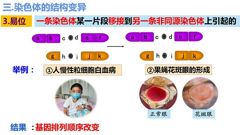 5.2染色体变异（第3课时）课件PPT06
