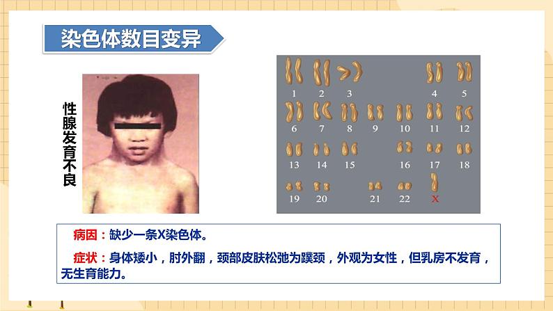 5.2染色体变异  课件 新人教版生物必修208