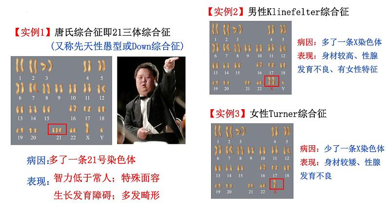 2023届高三生物一轮复习：染色体变异 课件第5页