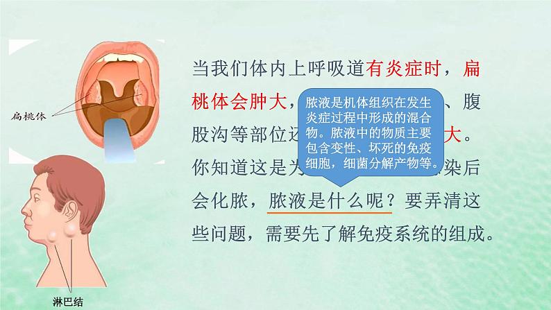 高中生物2023—2024年新人教版选择性必修一4.1免疫系统的组成和功能（课件+教案）（2份）04