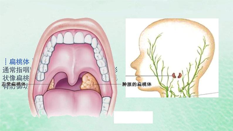 高中生物2023—2024年新人教版选择性必修一4.1免疫系统的组成和功能（课件+教案）（2份）07