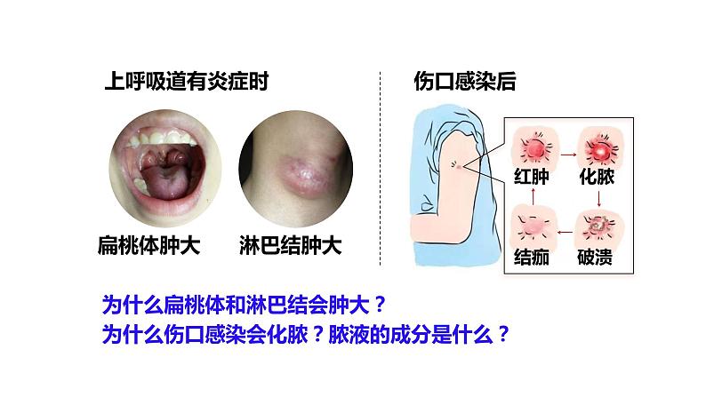 4.1免疫系统的组成和功能 课件高中生物选择性必修一05