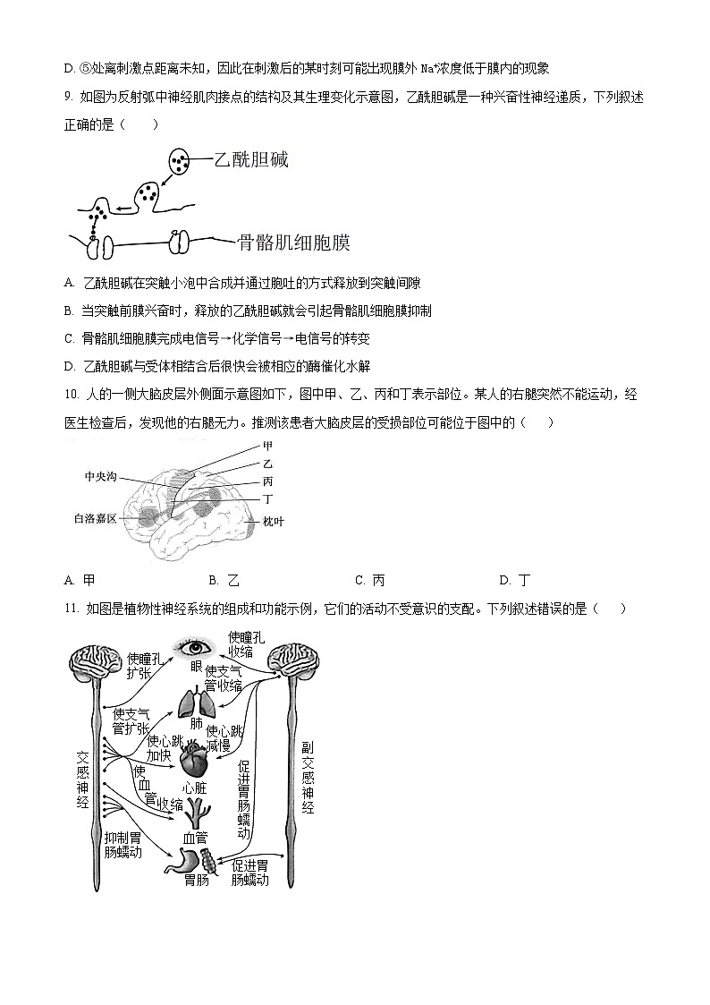 2023嘉兴八校联盟高二上学期期中联考生物试题含解析03