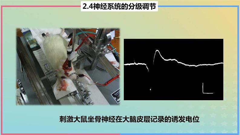 2023_2024学年同步备课精选高中生物2.4神经系统的分级调节课件新人教版选择性必修1第8页