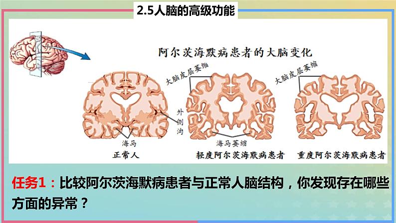 2023_2024学年同步备课精选高中生物2.5人脑的高级功能课件新人教版选择性必修1第8页