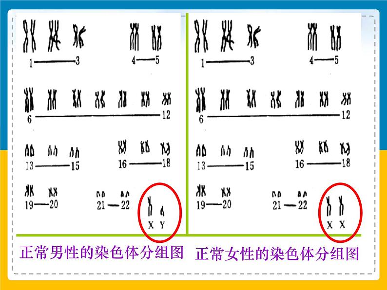 伴性遗传伴性遗传课件PPT03