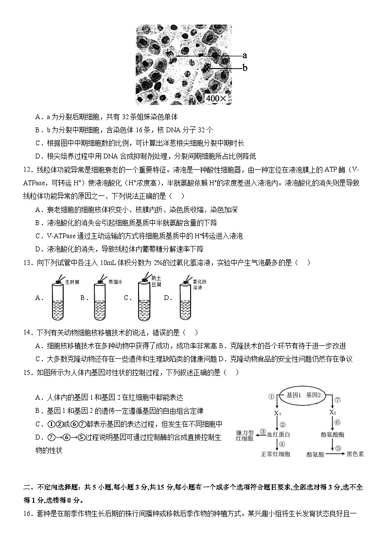 2024辽宁省实验中学高三上学期高考适应性测试（一）生物试题含答案03