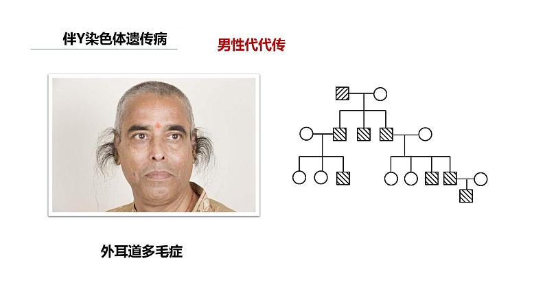 人教版高中生物必修二5.3人类遗传病课件+同步分层练习（含答案解析）08