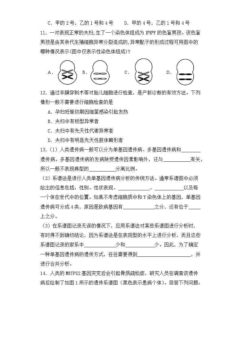 人教版高中生物必修二5.3人类遗传病课件+同步分层练习（含答案解析）03