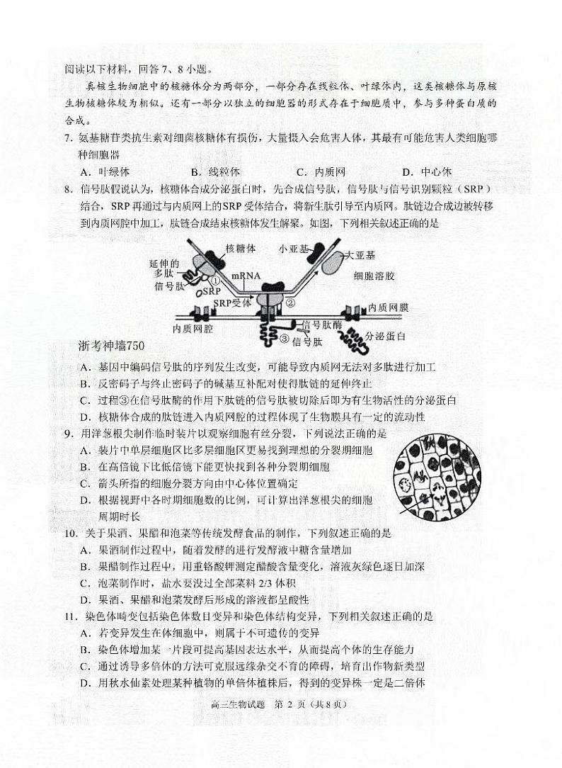 【浙江卷】浙江省诸暨市2023年12月高三适应性考试生物02