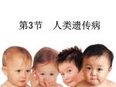 5.3 人类遗传病-【生物PPT课件】2023-2024学年高中生物必修二同步PPT课件