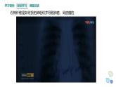 4.1 课时1 基因突变可能引起性状改变 课件 2023-2024学年高一生物浙科版（2019）必修2