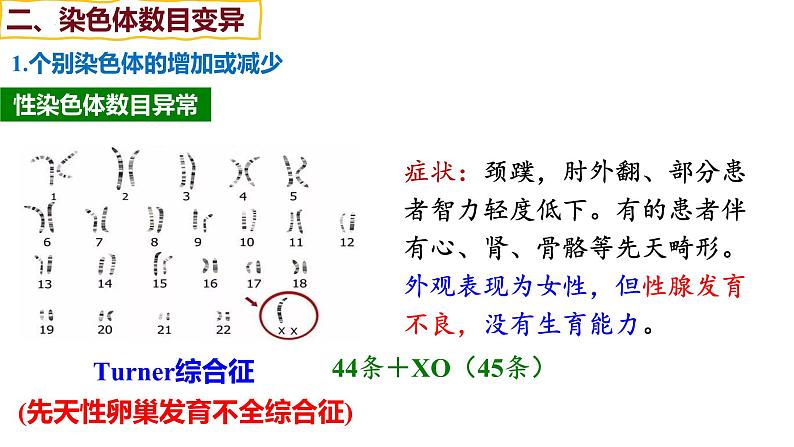 备战高考生物一轮复习优质课件 第20讲 染色体变异08