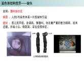 2023-2024学年浙科版（2019）必修2 4.3染色体畸变可能引起性状改变（第1课时）课件
