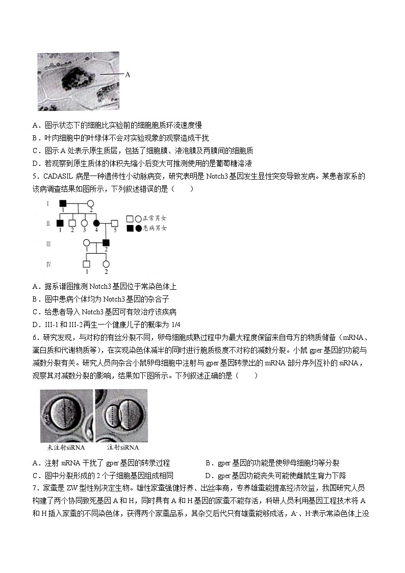 2024届贵州省贵阳市高三适应性测试（一）生物试题02