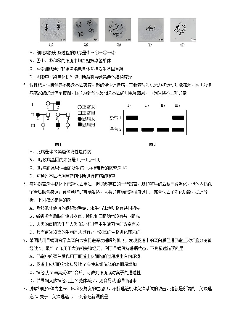 2024届北京市门头沟高三一模生物试题02