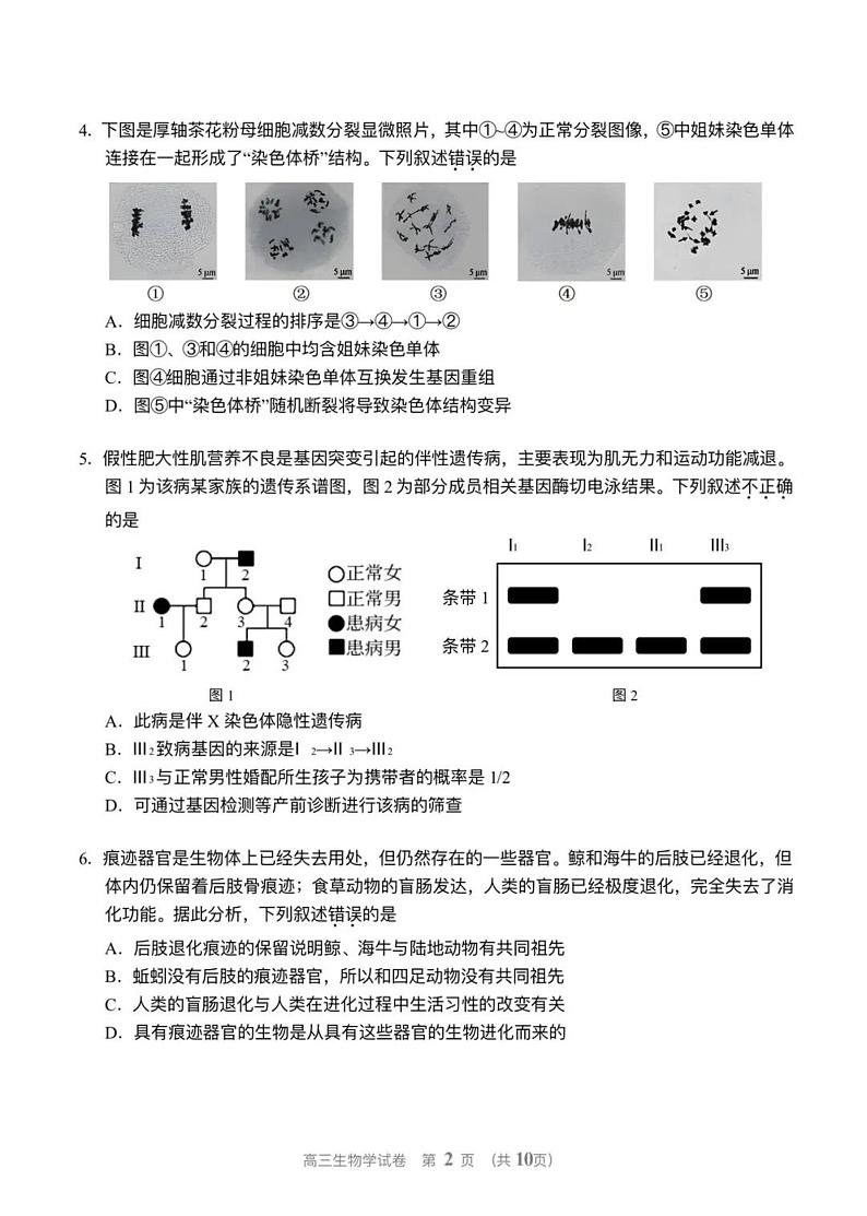 北京市门头沟区2024年高三年级综合练习 生物试题+答案（门头沟一模）第2页