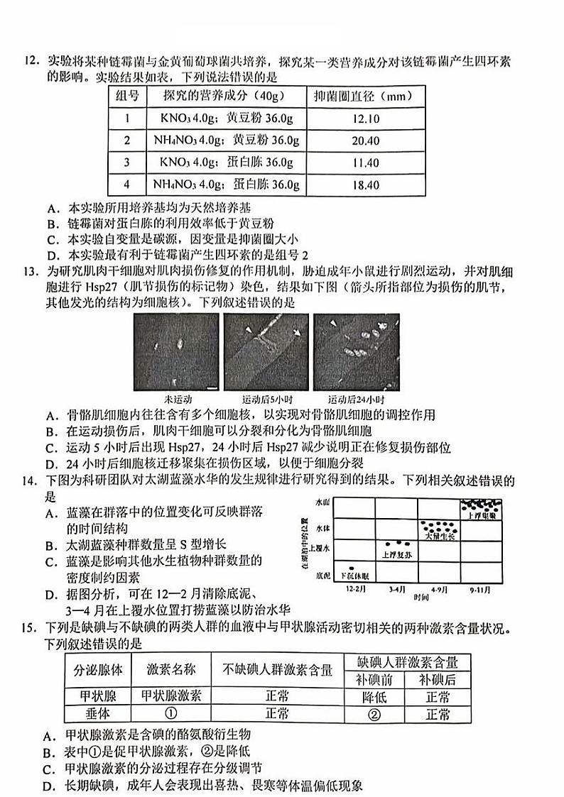 浙江省东阳市2023-2024学年高三下学期5月适应性考试生物试卷03