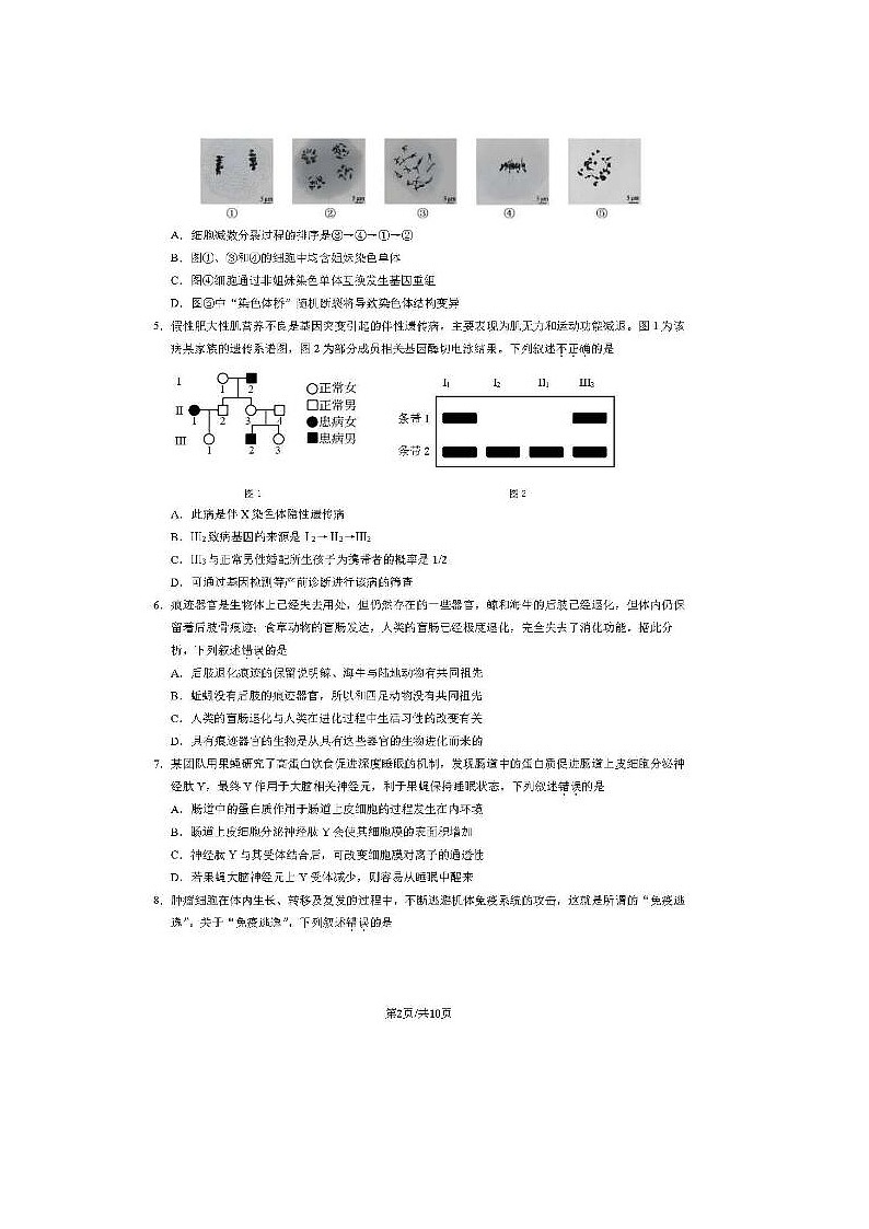 2024届北京门头沟高三一模生物试题第2页