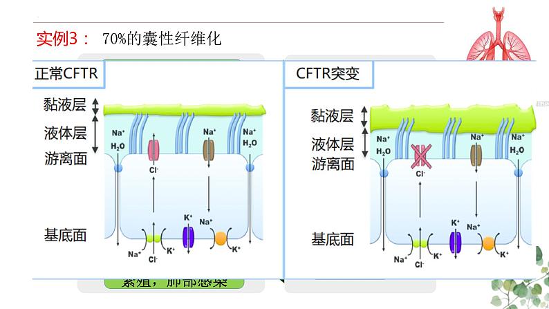 4.2 基因表达与性状的关系-高一生物下学期教学课件（人教版2019必修二）06