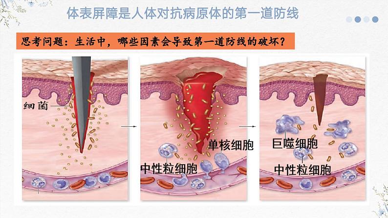 4.2人体通过非特异性免疫对抗病原体（教学课件）——高中生物学浙科版（2019）选择性必修一第8页