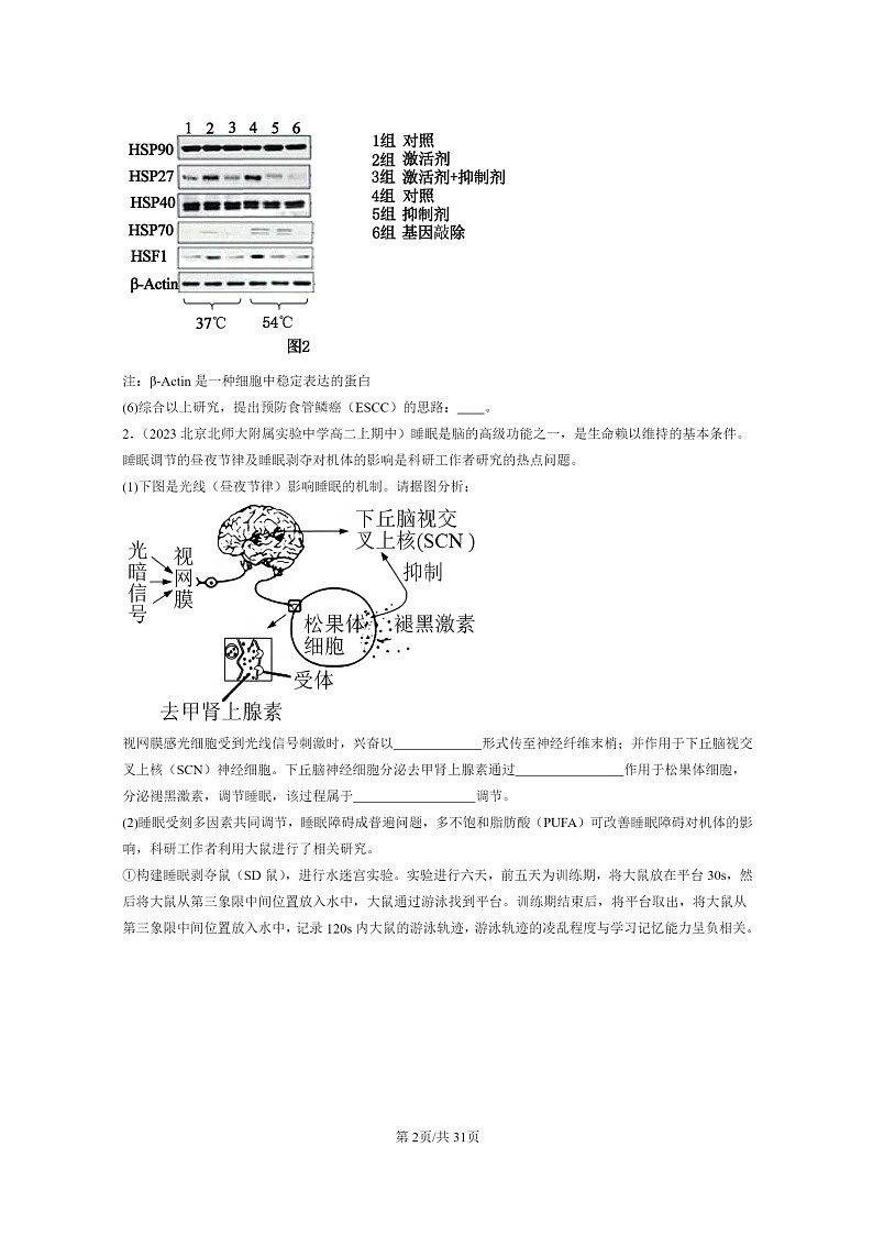 [生物]2023北京重点校高二上学期期中生物真题分类汇编：神经调节章节综合(非选择题)02