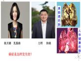 人教版 (新课标)必修1《分子与细胞》 6.4细胞的癌变课件