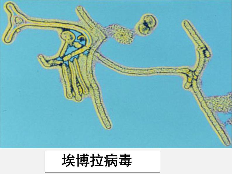 人教版高中生物选修3专题4第3节禁止生物武器（共38张PPT）第6页