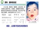 人教版高中生物必修二 5.2染色体变异 第3课时  染色体结构的变异 课件