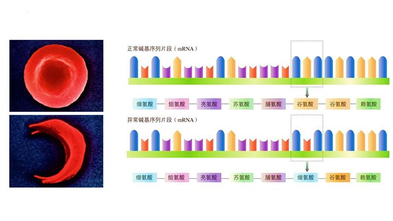 人教版（2019）高中生物必修二 第四章 第二节 基因表达与性状的关系 课件ppt第7页