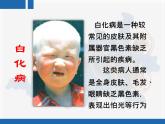 人教版 (新課標)高中生物 必修2 4-2《基因對性狀的控制》復習課件