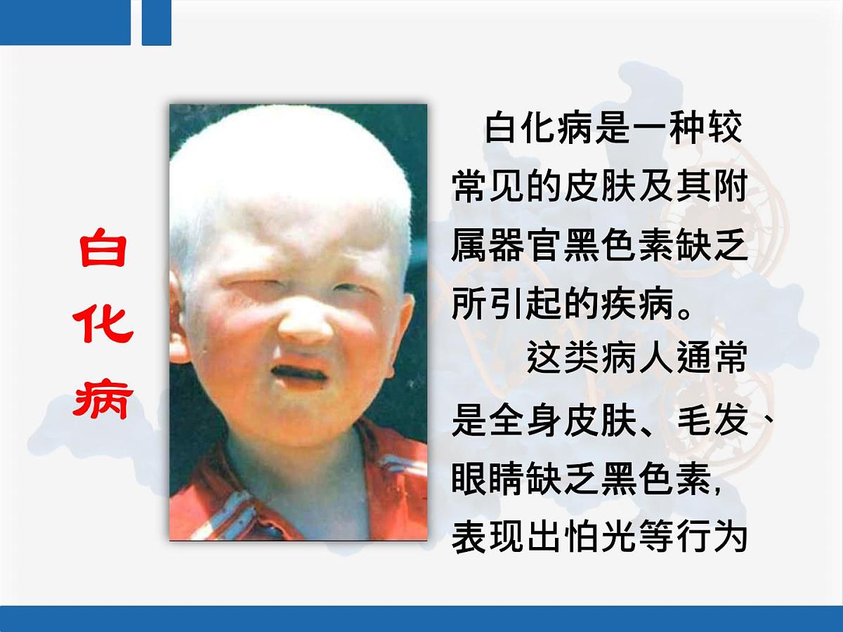 人教版 (新课标)高中生物 必修2 4-2《基因对性状的控制》复习课件第5页