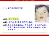 人教版 (新課標(biāo))高中生物必修2 5-2《染色體變異》課件