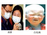 人教版 (新課標(biāo))高中生物必修2 5-3《人類遺傳病》課件
