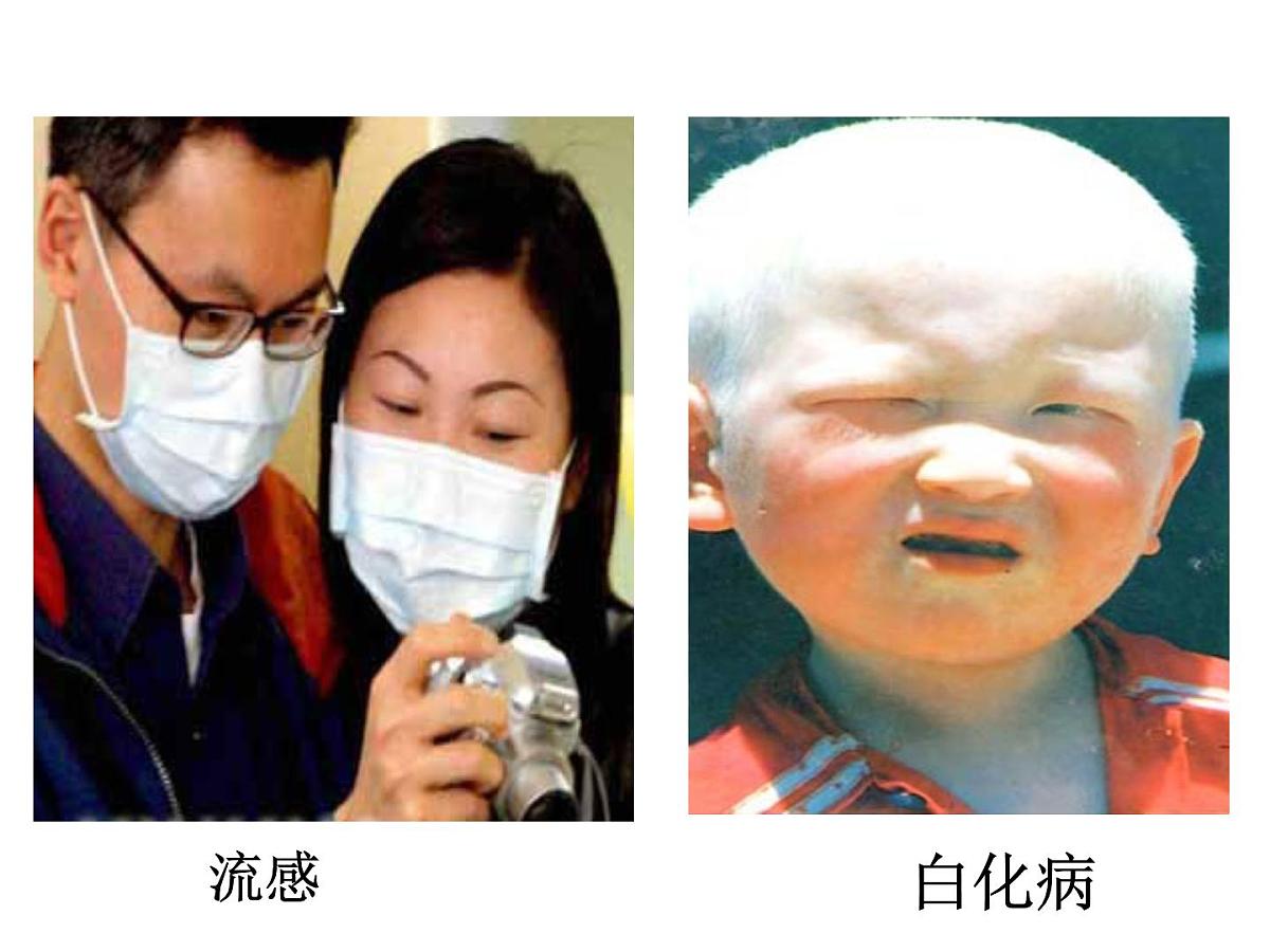 人教版 (新课标)高中生物必修2 5-3《人类遗传病》课件第2页