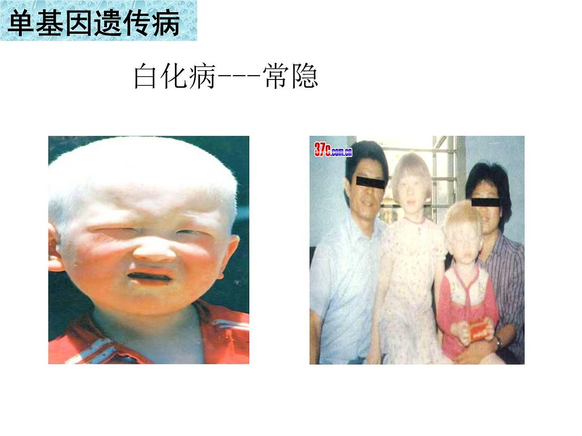 人教版 (新课标)高中生物必修2 5-3《人类遗传病》课件第6页