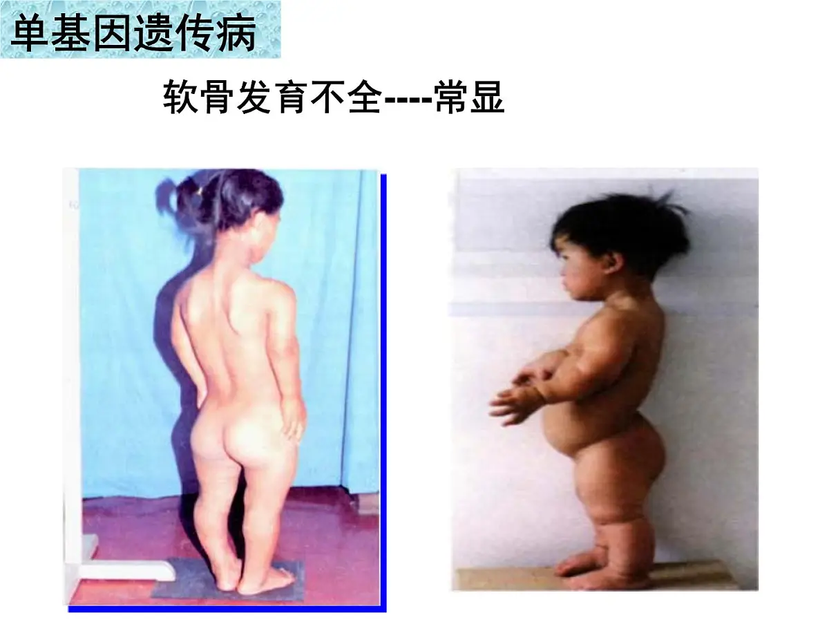 人教版 (新课标)高中生物必修2 5-3《人类遗传病》课件第8页