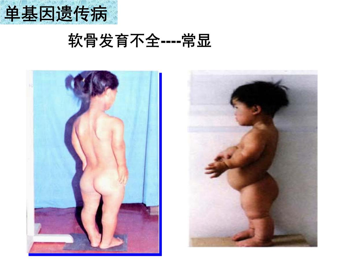 人教版 (新课标)高中生物必修2 5-3《人类遗传病》课件第8页