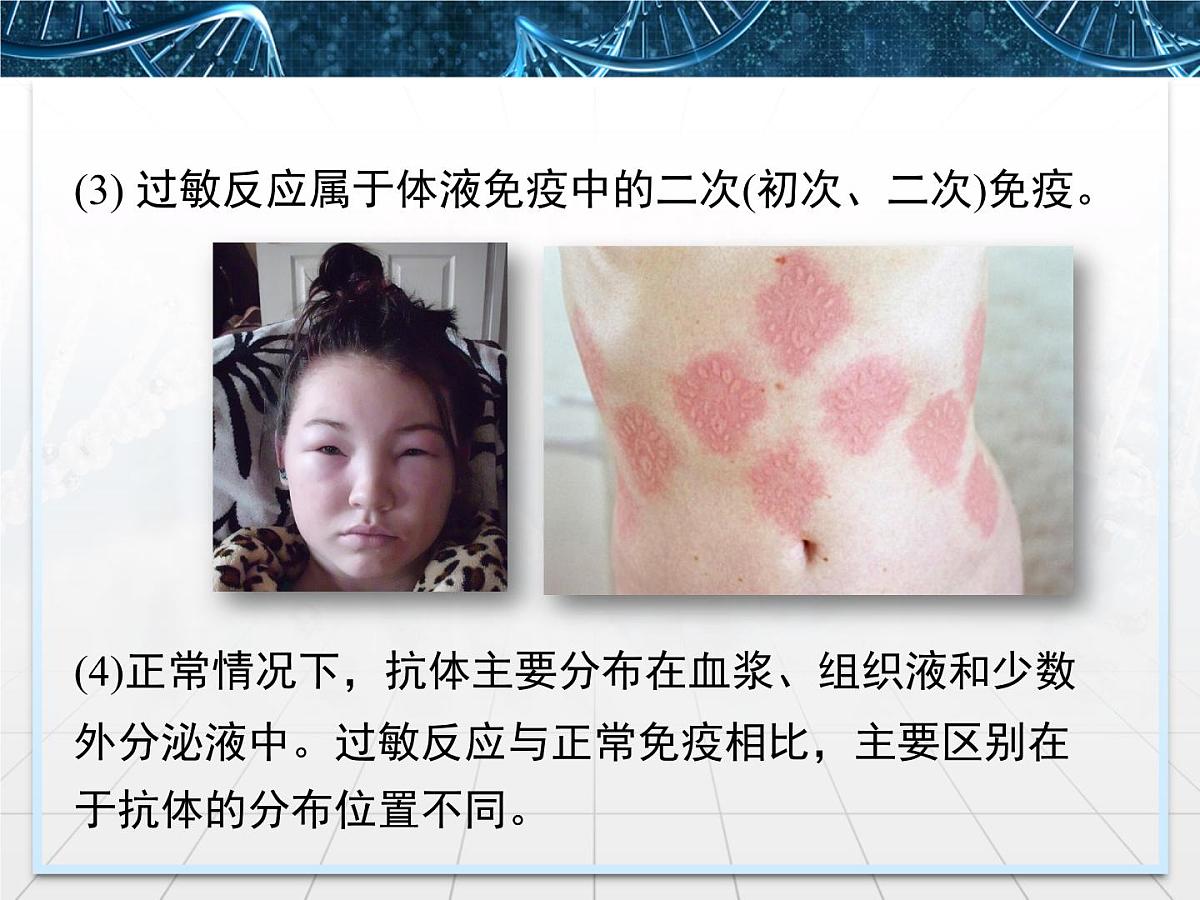 人教版 (新课标)高中生物必修3 2-4《免疫调节》第2课时课件第7页
