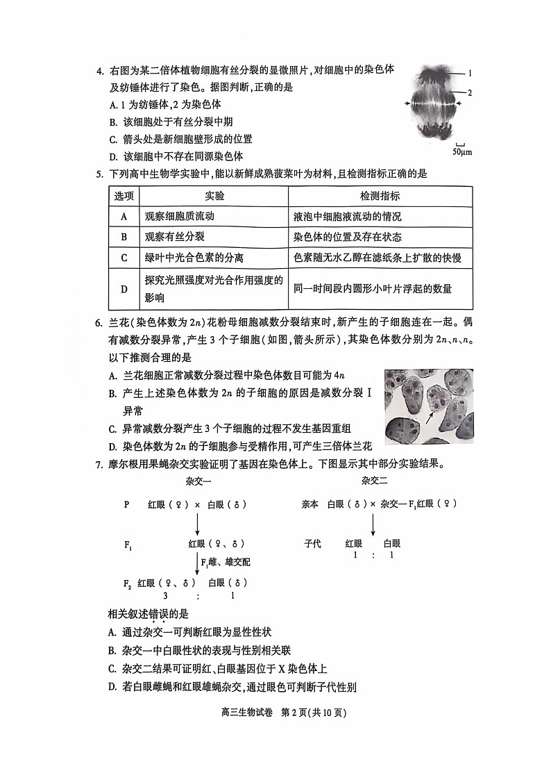 2025届北京市朝阳区高三下学期11月期中质量检测-生物试卷（含答案）第2页
