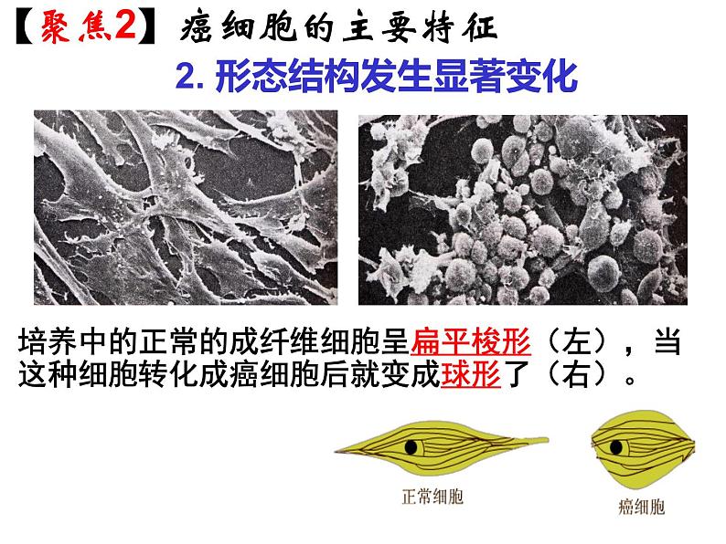 人教版高一生物必修1课件：6.4 细胞的癌变 （共25张PPT）08