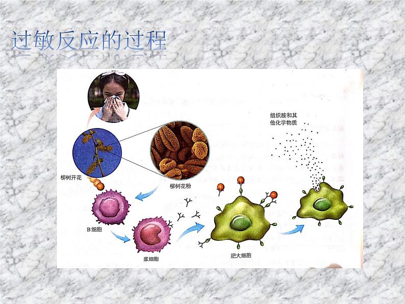 4.3免疫失调 课件08