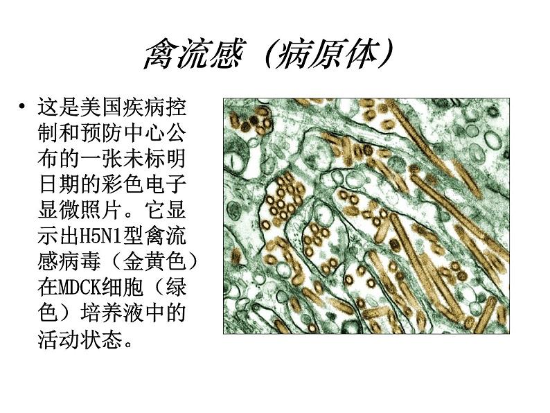 生物：2.4《动物疫病的控制》课件（2）（新人教版选修2）07