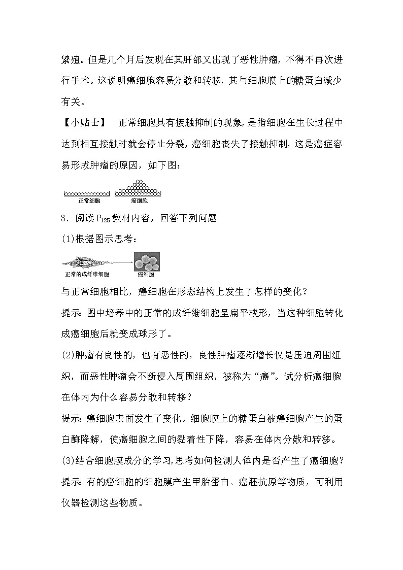 人教版高中生物必修一分子与细胞6.4 细胞的癌变导学案02
